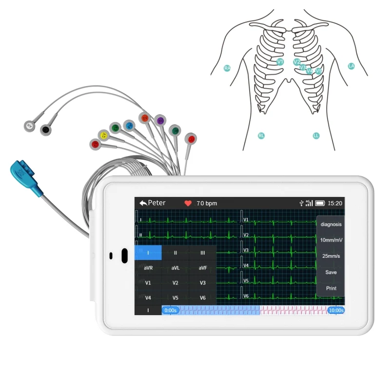 Máquina de ECG de bolsillo de 12 derivaciones