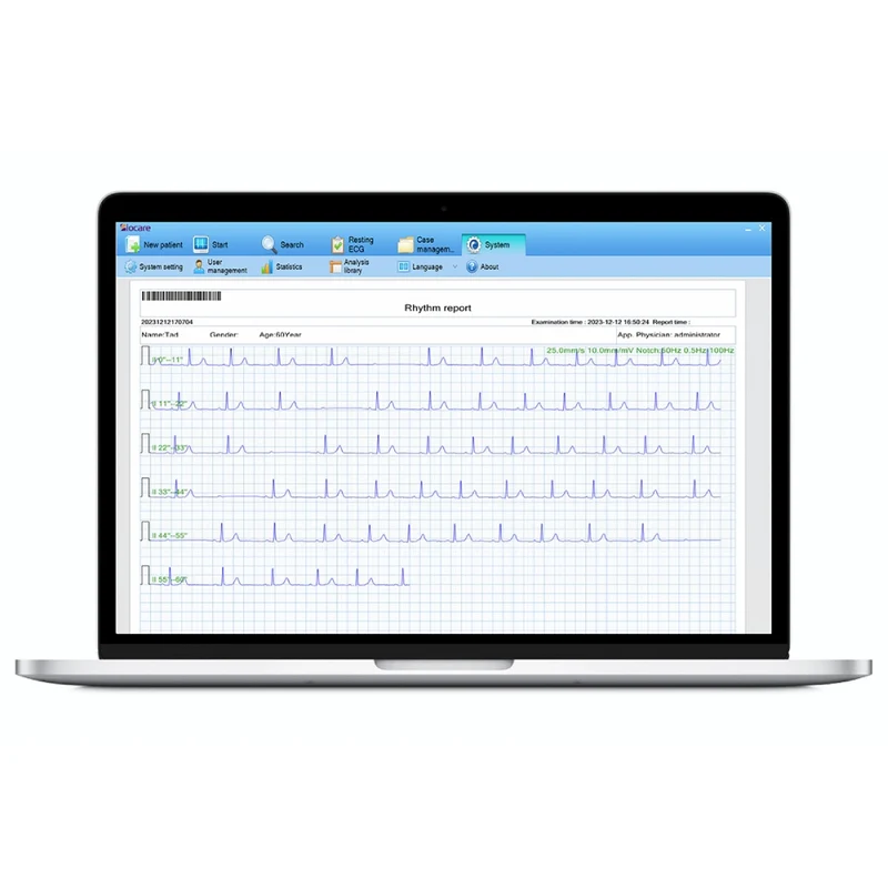 Sistema de gestión de ECG